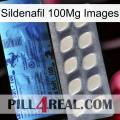 Sildenafil 100Mg Images 34